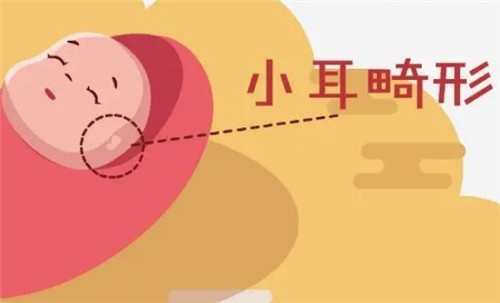 【河南中醫(yī)藥大學(xué)一附院】莊洪興教授暑假坐診，耳畸形修復(fù)限時預(yù)約！