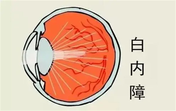上海醫(yī)大眼科白內(nèi)障手術(shù)8千-3萬起，不同品牌晶體價(jià)格有些許差異