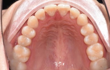 重慶牙博士口腔牙齒矯正