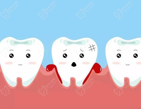 重慶牙博士口腔醫(yī)院口腔護(hù)理科