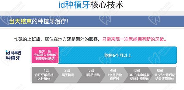 韓國(guó)id醫(yī)院牙科種植牙核心技術(shù)