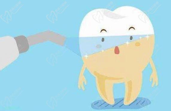 viva冷光美白是國產的嗎？
