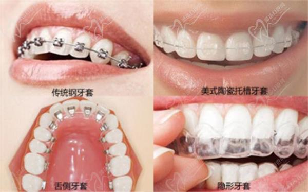 寧波陌客爾口腔牙齒矯正怎么樣價(jià)格貴嗎？