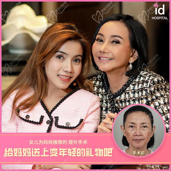 韓國(guó)id整形醫(yī)院面部提升術(shù)后圖