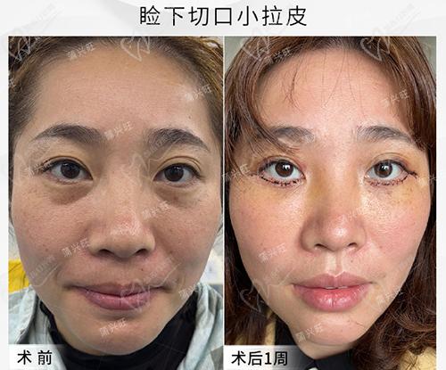 成都蒲興旺小拉皮口碑范例