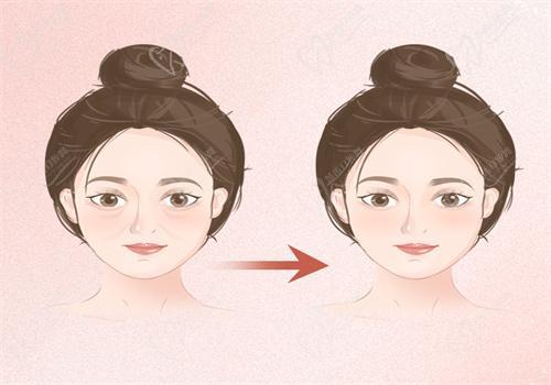 韓國(guó)必當(dāng)歸崔泰錫院長(zhǎng)