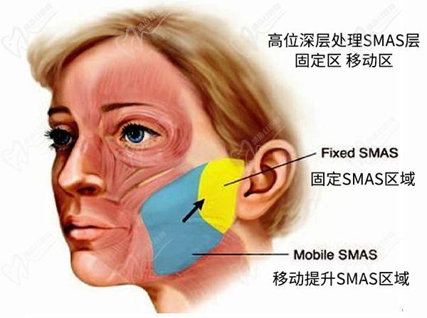 廣州朱云醫(yī)生拉皮技術優(yōu)勢