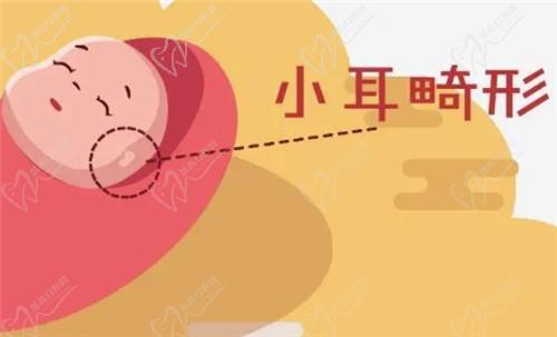 什么是耳畸形？哪些情況需要治療？