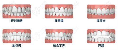 杭州整形醫(yī)院口腔科牙齒矯正多少錢？