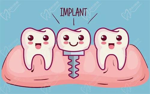 武漢中諾口腔劉博聞醫(yī)生的種植牙技術(shù)高超