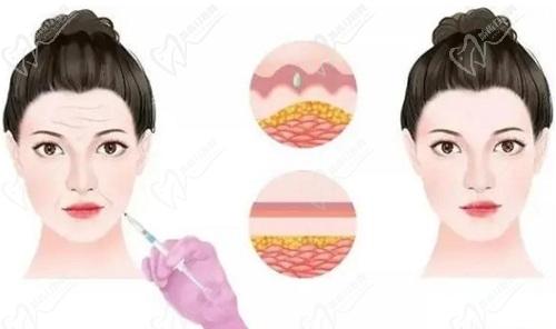 北京新星靚肖慶彥