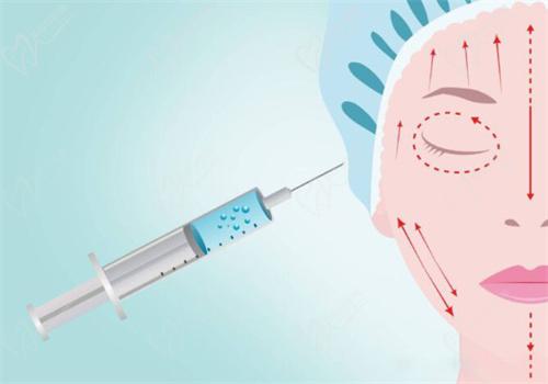 貴陽(yáng)華美紫馨玻尿酸注射價(jià)格