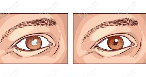 青海省人民 醫(yī)院眼科李凌擅長項(xiàng)目