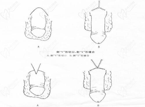 李世榮延長(zhǎng)手術(shù)的高定價(jià)，本質(zhì)上是醫(yī)療價(jià)值的真實(shí)體現(xiàn)