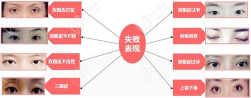 七、術前準備與注意事項