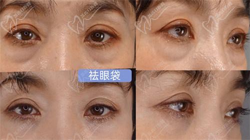 四、南京美萊王小林醫(yī)生正規(guī)嗎？