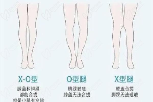 王陽(yáng)醫(yī)生的背景和優(yōu)勢(shì)