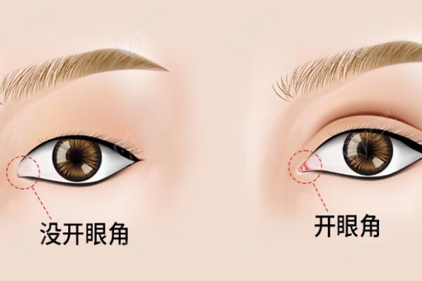 北京魯禮新醫(yī)生做鼻子和雙眼皮醫(yī)生簡介
