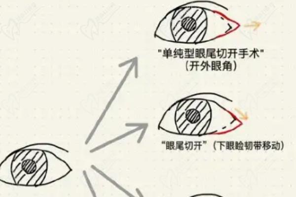 北京魯禮新醫(yī)生做鼻子和雙眼皮醫(yī)醫(yī)生坐診醫(yī)院