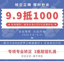 北京斯邁爾口腔世界正畸日活動，牙齒矯正正畸限時秒殺9.9抵用1000元