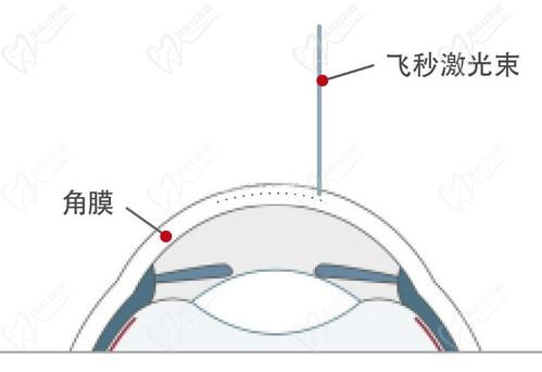 王曉瑛醫(yī)生在哪里出診？上海普瑞、上海和平等眼科醫(yī)院可預(yù)約