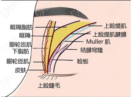 師麗麗雙眼皮修復(fù)成功率大嗎？看了好多真人修復(fù)實例和口碑評價無黑料