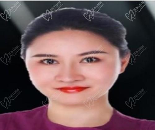 李雪琴