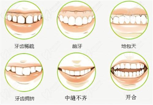 重慶牙博士口腔整牙多少錢？速看重慶牙博士口腔牙齒矯正價(jià)格表